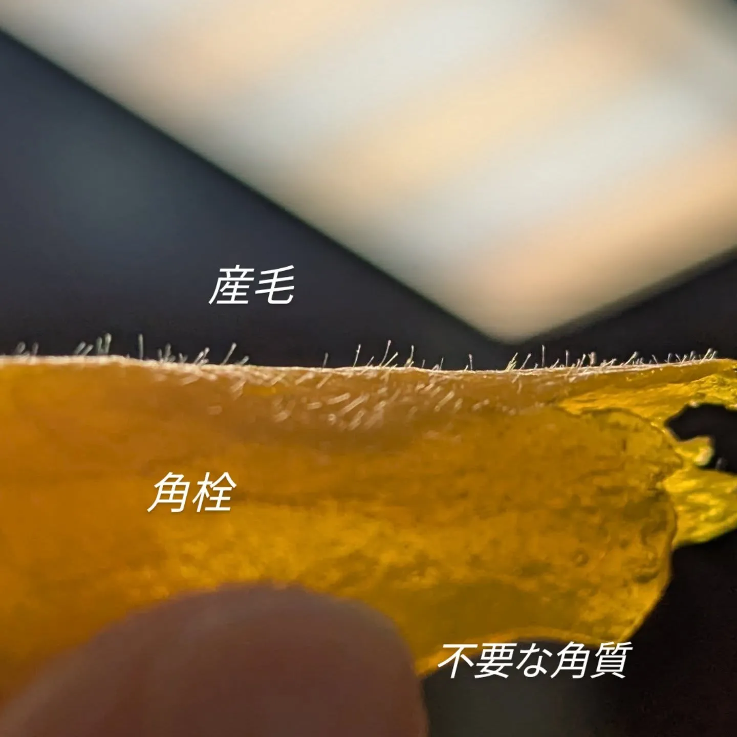 【新メニュー美肌サポートフェイシャルWAX】